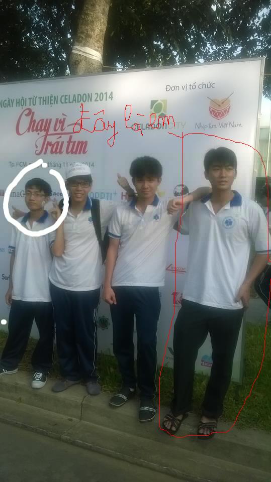 Lùn tâm thần.jpg