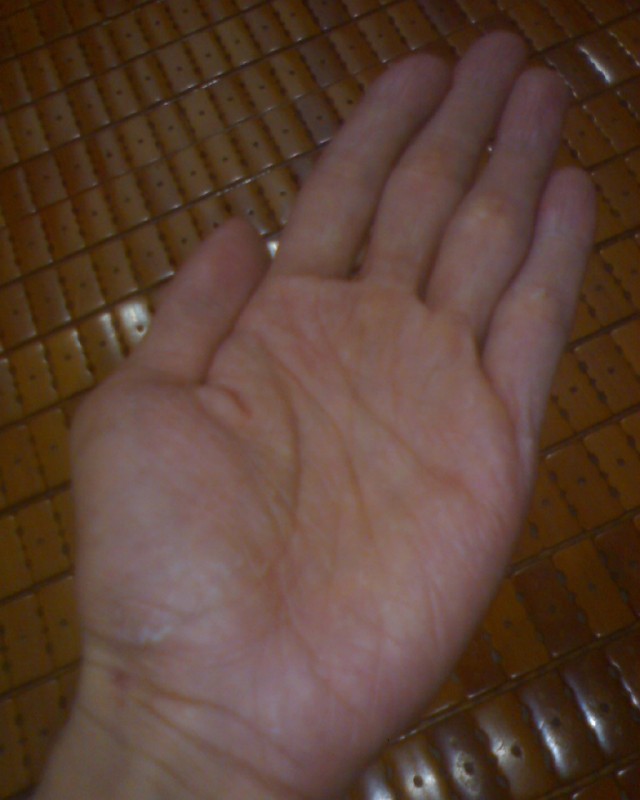 Lòng bàn tay trái