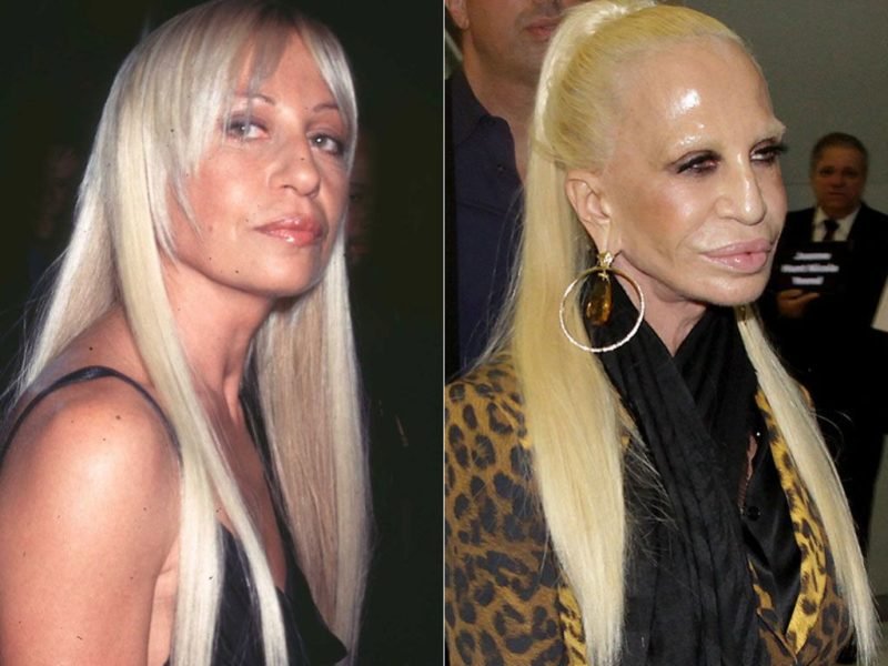 donatella-before-after-800x600.jpg